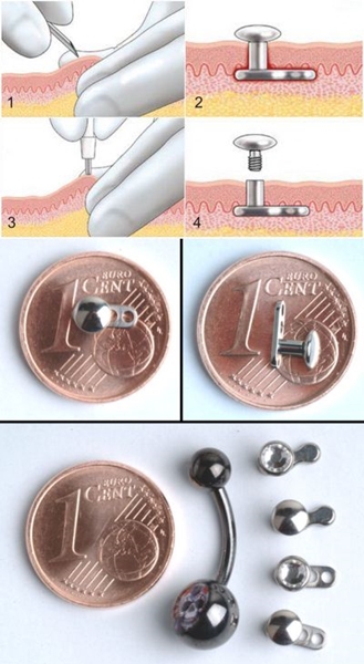 Microdermal פירסינג: איך microdermabras נעשים (תמונה)