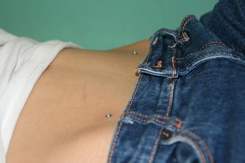 Microdermal פירסינג: איך microdermabras נעשים (תמונה)