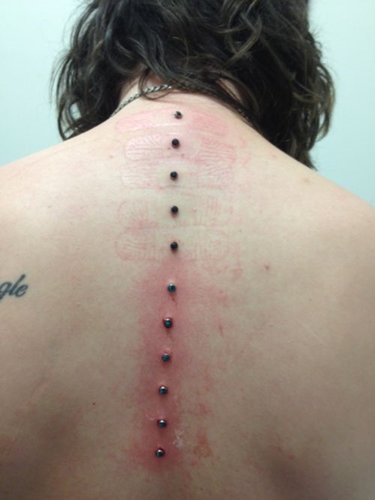 Microdermal פירסינג: איך microdermabras נעשים (תמונה)