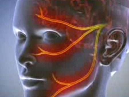 Neuralgia: סימפטומים, תמונות, טיפול